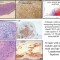 pathology diagnosis