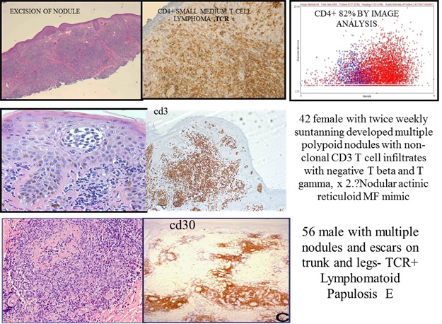 pathology diagnosis